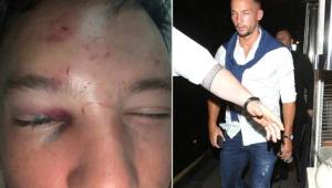 Danny Drinkwater recibió una brutal paliza por intentar ligar a la pareja de otro jugador en un club nocturno. // Fotos cortesía The Sun.