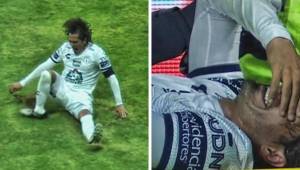 Así fue la terrible lesión del jugador de Pachuca.