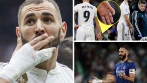 Karim Benzema siempre juega con la mano vendada en el Real Madrid y el jugador ha explicado el por qué.
