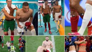 Las mejores imágenes que nos dejó el Portugal-Francia por la Eurocopa; Cristiano rompe importante récord y lo que sucedió con Mbappé al final del partido.
