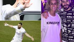 Karim Benzema sigue con un daño en el dedo meñique de su mano derecha.