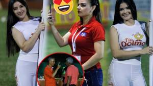 Honduras Progreso y Platense abrieron la jornada 13 de la Liga Nacional, y acá te dejamos las imágenes más curiosas del encuentro. Bellas chicas adornaron el Humberto Micheletti. (Fotos Neptalí Romero)