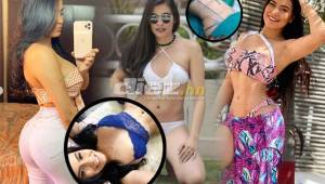 Alejandra Rubio, bella presentadora del canal Q'Hubo TV, luce en sus redes sociales el cuerpo tras unas cirugías plásticas a las cuales se sometió.