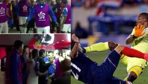 La Bicolor de Jorge Luis Pinto se midió en el Red Bull Arena ante los costarricenses en el debut de la Copa Oro. Honduras perdió 1-0.
