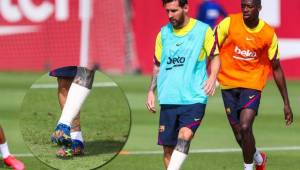 El Barcelona cubre la parte afectada del tobillo de Lionel Messi con un fuerte vendaje.