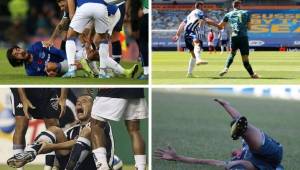 Santiago Arias, futbolista de la selección de Colombia, es el último que se une a la lista de las lesiones más feas que se han visto.