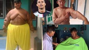 Hace algún tiempo, Arya Permana, de Indonesia, fue considerado el niño más obeso del mundo. Llegó a pesar casi de 200 kilos. Sueña con ser futbolistas, está a la espera de una operación para quitarse la piel sobrante y este ha sio su tremendo cambio físico.