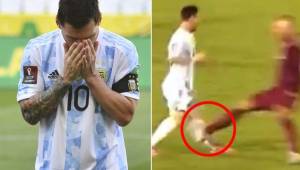 Messi sufrió una entrada criminal el pasado jueves ante Venezuela por las Eliminatorias.