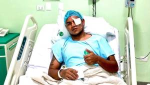 El jugador del Marathón Mario Martínez pasó la noche en el hospital tras recibir el fuerte codazo del jugador del Olimpia Jonathan paz, que le rompió la cara.