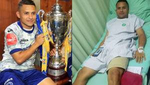 Omar Elvir festejó a medias la Copa 15 del Motagua, el jugador viajó este lunes a San Pedro Sula para someterse a una operación.