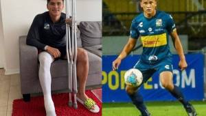 El defensor hondureño Denil Maldonado se encuentra en recuperación en Viña del Mar, Chile tras ser operado del tobillo. Se queda en Everton hasta diciembre.