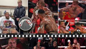 La pelea organizada por Netflix tuvo como claro ganador al boxeador británico y el youtuber estadounidense mostró en redes sociales el resultado de la lesión sufrida.