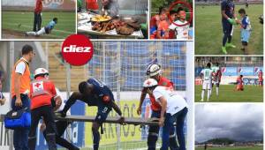 Se completó la fecha 3 del Apertura 2018 en Honduras y estas son las imágenes curiosas de los partidos dominicales.