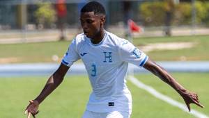 El defensor de la Selección de Honduras y el Alverca FC de España, volverá hasta septiembre cuando se recupere de la lesión de rodilla que lo apartó de las canchas en el último mes.