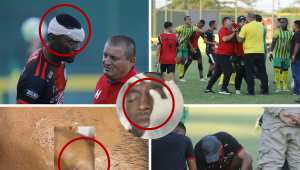 El futbolista Brayan Flowers fue el más afectado ya que recibió más de siete puntos de sutura. Alejandro Raudales también recibió una herida profunda en su rostro.