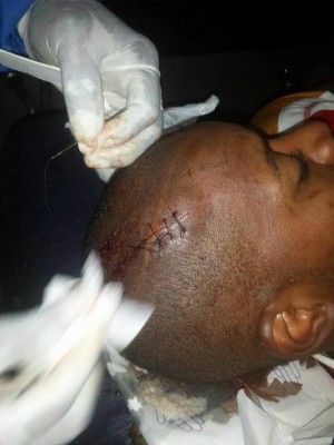 FOTOS: Así quedaron Yul Arzú y Portigliatti tras el Motagua-Juticalpa