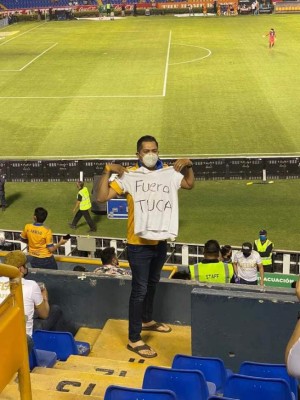 ''Juego de Barbies'': figura de Tigres explota y así quedó la pierna de jugador del América en la Liga MX