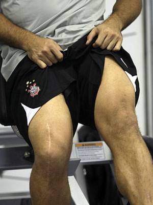 Las espeluznantes y temibles operaciones a los futbolistas