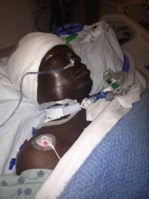 Murió Jean-Pierre Adams tras 39 años en coma: la negligencia médica que marcó la vida del exjugador del PSG