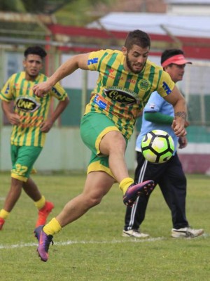 Así se mueve el mercado de piernas en el Ascenso de Honduras