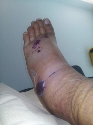 27 fotos que demuestran que Australia es un país 'aterrador' para vivir