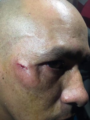 ¡Ya paren! Las repudiables agresiones a los árbitros en el fútbol hondureño