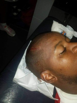 FOTOS: Así quedaron Yul Arzú y Portigliatti tras el Motagua-Juticalpa