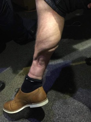 Las espeluznantes y temibles operaciones a los futbolistas