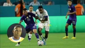Carlo Costly sobre el amistoso ante Argentina: “Es difícil calificar a una selección de Honduras que no jugó a nada”