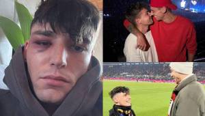 Lamentable. El árbitro alemán Pascal Kaiser le pidió matrimonio a su novio en pleno partido de la Bundesliga y una semana después ha pasado por un terrible episodio.