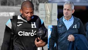 Luis “Buba” López está en duda para el repechaje ante Costa Rica y Reinaldo Rueda deberá tomar una decisión para elegir el portero.