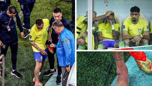 ¡Neymar lesionado! Qué tiene, cuánto tiempo estará de baja y qué partidos se perdería con Brasil en el Mundial Qatar 2022