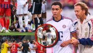 Jamal Musiala vuelve a desplomarse en juego amistoso del Bayern Múncih y preocupa a todos: esto es lo que se sabe sobre el estado de salud del joven futbolista de Alemania.