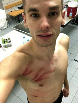 Durísimo: Futbolista sufre patada criminal y muestra cómo quedó su pecho