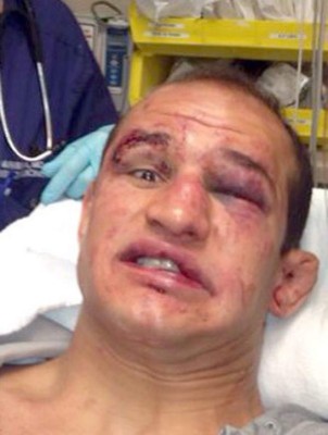 Fotos: Los golpes más espeluznantes en la UFC