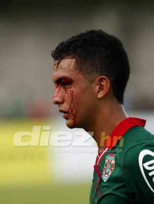 Las imágenes que no viste en televisión del Marathón-Motagua