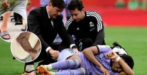 El mediocampista del Real Madrid, Dani Ceballos, sufrió una dura falta por parte de Marcos Acuña en la parte final del partido.