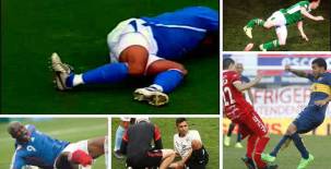 Golpes en la cara, fracturas de tibia y peroné, rodilla o piernas, así han sido las lesiones más espeluznantes que han vivido varios jugadores del fútbol.