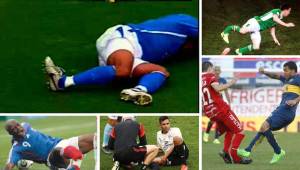 Golpes en la cara, fracturas de tibia y peroné, rodilla o piernas, así han sido las lesiones más espeluznantes que han vivido varios jugadores del fútbol.