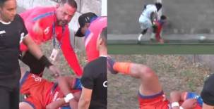 ¿Era roja directa? jugador de Lobos UPN estrelló toda su cara contra el muro tras disputa con Elison Rivas