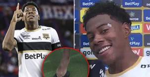 Dereck Moncada muestra el golpe que sufrió tras marcar doblete en Colombia y confiesa: Él es mi referente, sigo sus pasos