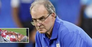 Bielsa y un golpe demoledor con Uruguay: se fracturó y está fuera del Mundial 2026
