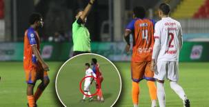 El fuerte castigo a José García tras ver la roja por tocarle los glúteos a Chirinos en el Olimpia-UPN