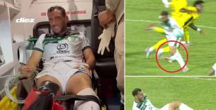 Fabricio Silva sufre espantosa lesión en el Real España-Juticalpa que se disputó en el Morazán