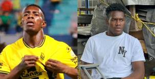 Dixon Ramírez revela cuánto tiempo estará fuera y ¿considera que perjudican a Real España?: Como que lo ignoran a uno