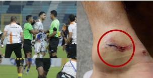 Lobos UPNFM gira contundente comunicado tras brutal falta de cárcel en el duelo ante Real España: El fútbol exige justicia. FOTOS: Edwin Romero.