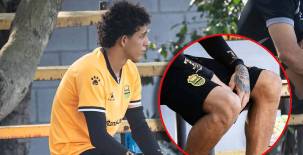 Nixon Cruz no entrenó con Real España y es baja confirmada ante Olimpia. FOTO: Mauricio Ayala.