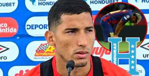 José Mario Pinto confesó en conferencia de prensa que sufre la misma lesión que Lamine Yamal, futbolista de Barcelona.