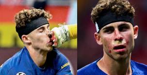 Fermín y la herida que le dejó el encuentro entre el Barcelona y Atlético de Madrid. Fotos cortesía.