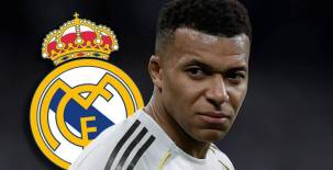 El delantero francés es el máximo goleador de la Champions League y podría perderse el juego de vuelta ante Benfica.